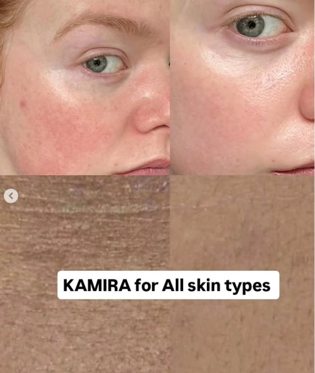 GOLD & CAVIAR SERUM – Image 7